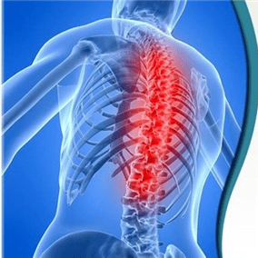 Bizkarrezurreko osteochondrosia hainbat arrazoirengatik izan daiteke